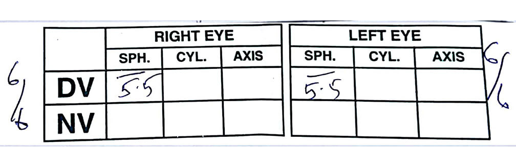 Single Vision - Astigmatism